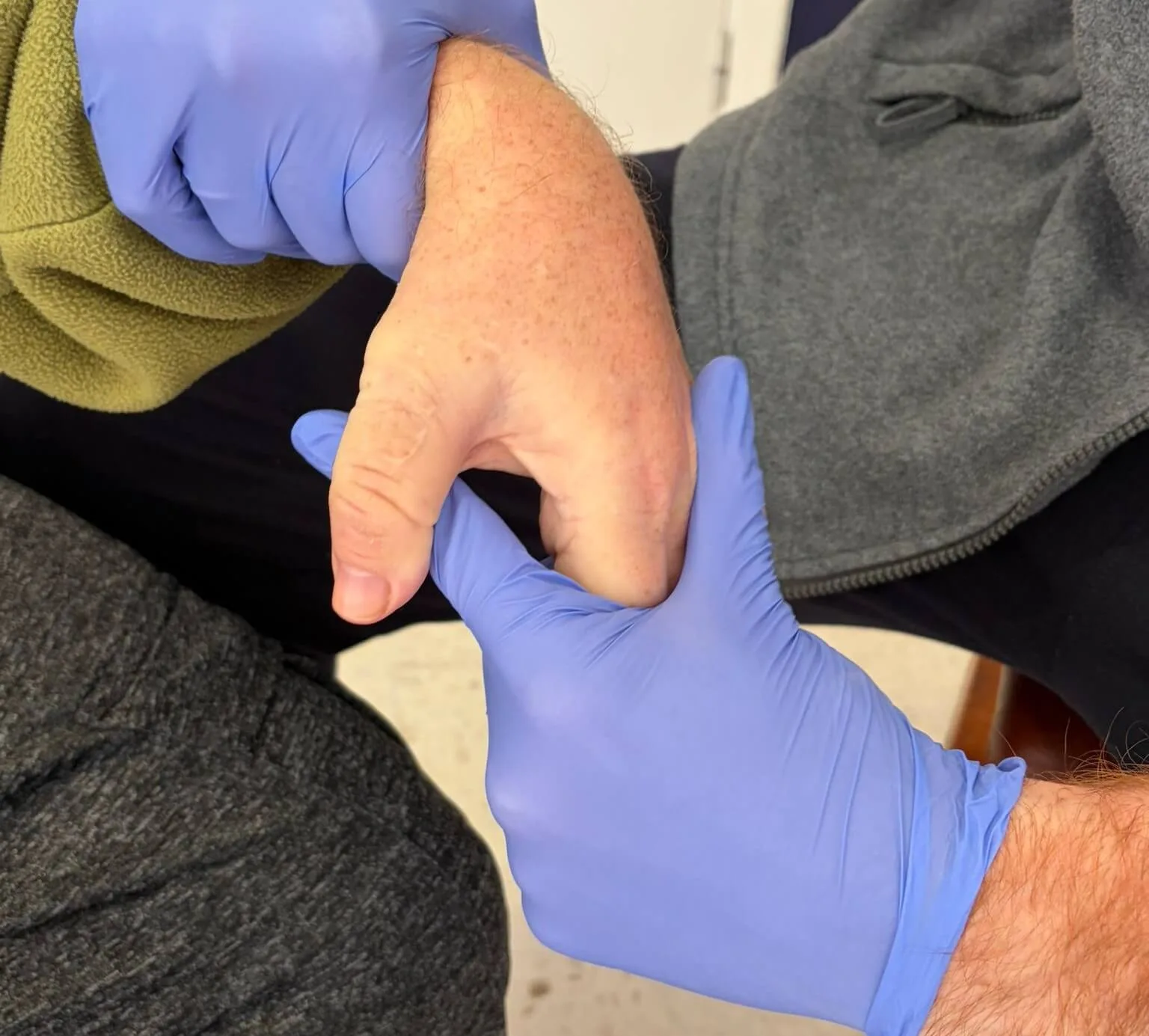 Ejercicios para rehabilitacion mano ictus